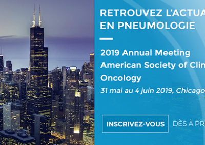 ASCO 2019 – Actualités en pneumologie